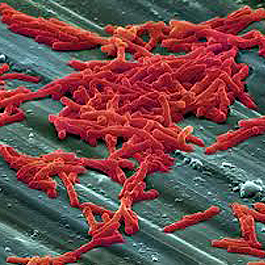 Antimicrobial Cosmetic Chemicals Antimicrobial Cosmetic Chemicals